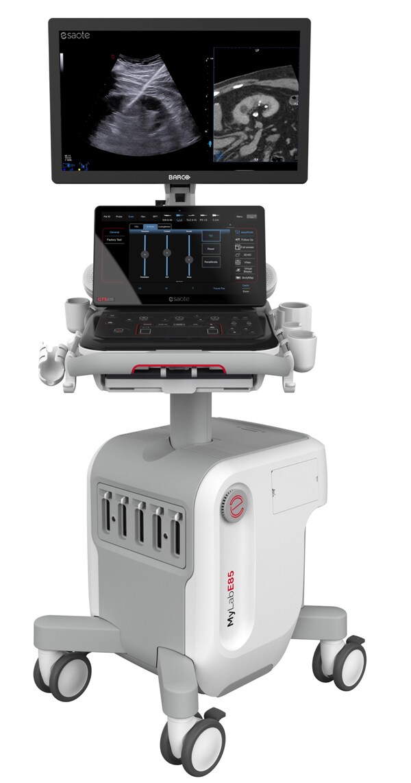 ECR 2026: Esaote Group Introduces Breakthroughs in Ultrasound, MRI and Enterprise Imaging